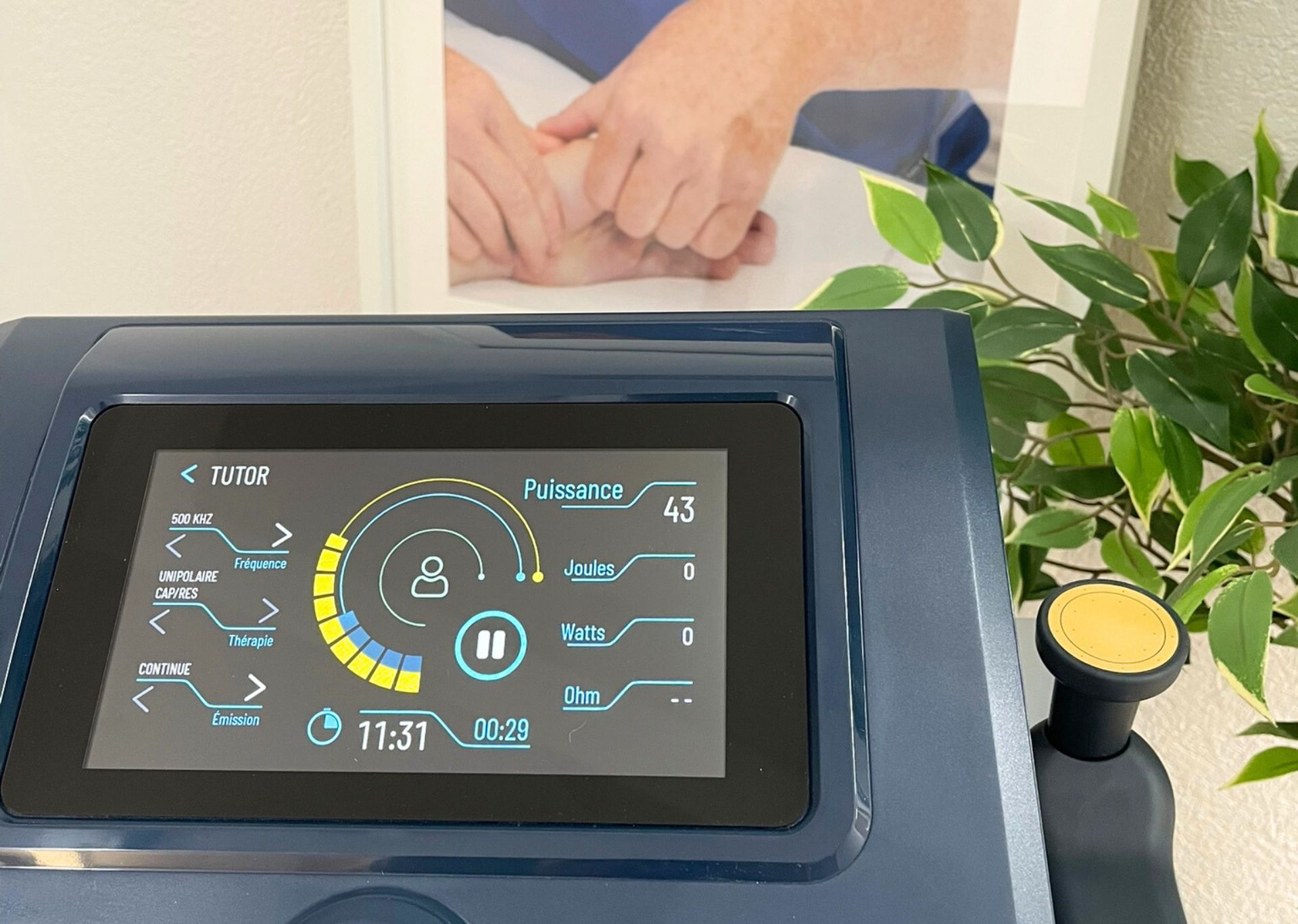 Tecar thérapie chez Physio Clinics - spons de physiothérapie